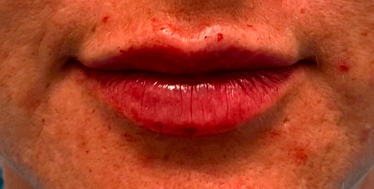 After image